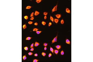 Immunofluorescence analysis of L929 cells using GBP2 Rabbit pAb  at dilution of 1:100 (40x lens). (GBP2 Antikörper  (AA 410-520))