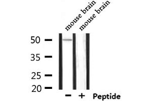 Western blot analysis of extracts from mouse brain, using KCNJ4 Antibody. (KCNJ4 Antikörper  (Internal Region))