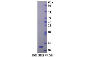 SDS-PAGE (SDS) image for Cholesteryl Ester Transfer Protein (CETP) (AA 353-443) protein (His tag) (ABIN1525386)