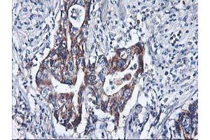 Image no. 2 for anti-Histidyl-tRNA Synthetase 2, Mitochondrial (Putative) (HARS2) antibody (ABIN1498585) (HARS2 Antikörper)