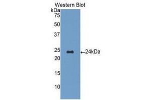 Western Blotting (WB) image for anti-Orosomucoid 1 (ORM1) (AA 19-201) antibody (ABIN1077768) (ORM1 Antikörper  (AA 19-201))