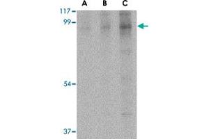 Western blot analysis of BRSK2 in human brain tissue lysate with BRSK2 polyclonal antibody  at (A) 0. (BRSK2 Antikörper  (C-Term))