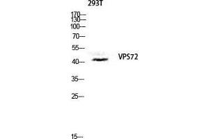 Western Blot (WB) analysis of 293T lysis using VPS72 antibody. (VPS72 Antikörper  (Internal Region))