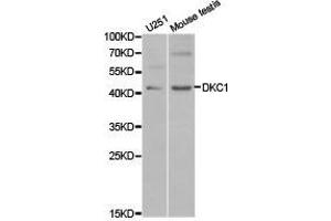 Western Blotting (WB) image for anti-Dyskeratosis Congenita 1, Dyskerin (DKC1) antibody (ABIN1872276) (DKC1 Antikörper)