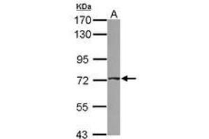 Image no. 1 for anti-ATP-Binding Cassette, Sub-Family D (Ald), Member 4 (ABCD4) (AA 38-296) antibody (ABIN1496386) (ABCD4 Antikörper  (AA 38-296))