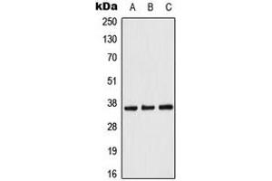 Western blot analysis of ACOT8 expression in Raji (A), NIH3T3 (B), PC12 (C) whole cell lysates.