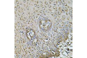 Immunohistochemistry of paraffin-embedded human esophagus using CPOX antibody (ABIN5971997) at dilution of 1/100 (40x lens). (CPOX Antikörper)