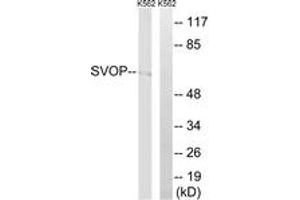 Western blot analysis of extracts from K562 cells, using SVOP Antibody. (SVOP Antikörper  (AA 271-320))