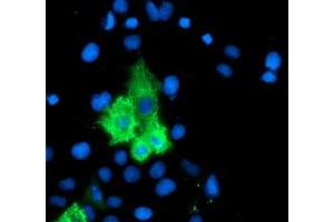 Anti-ALOX15 mouse monoclonal antibody (ABIN2455524) immunofluorescent staining of COS7 cells transiently transfected by pCMV6-ENTRY ALOX15 (RC206621). (ALOX15 Antikörper)