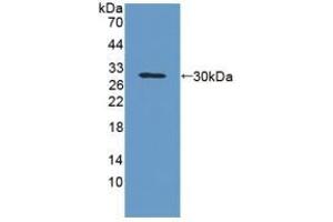 Detection of Recombinant GPA33, Rat using Polyclonal Antibody to Glycoprotein A33 (GPA33) (GPA33 Antikörper  (AA 22-235))