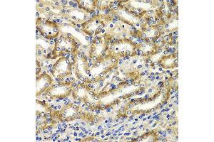Immunohistochemistry of paraffin-embedded mouse kidney using DGKE antibody at dilution of 1:100 (40x lens).