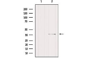 Western blot analysis of extracts from Rat heart, using SGCG Antibody. (SGCG Antikörper  (C-Term))