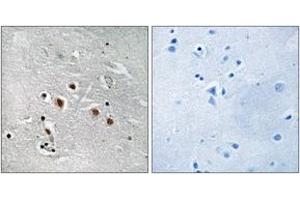 Immunohistochemistry analysis of paraffin-embedded human brain tissue, using MED13L Antibody. (MED13L Antikörper  (AA 449-498))