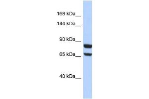 Host:  Rabbit  Target Name:  PGR  Sample Type:  HepG2 Whole cell lysates  Antibody Dilution:  1. (Progesterone Receptor Antikörper  (N-Term))