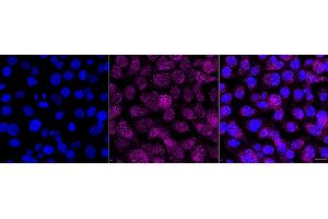 anti-Neutrophil Cytosolic Factor 4, 40kDa (NCF4) antibody