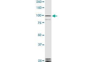 TLR9 monoclonal antibody (M04), clone 3B7 Western Blot analysis of TLR9 expression in NIH/3T3 .