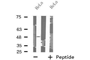 Western blot analysis of extracts from HeLa cells using MRPS27 antibody. (MRPS27 Antikörper  (N-Term))