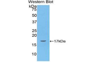 Western blot analysis of the recombinant protein. (ANGPTL4 Antikörper  (AA 286-409))