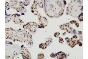 Immunoperoxidase of monoclonal antibody to THUMPD1 on formalin-fixed paraffin-embedded human placenta. (THUMPD1 Antikörper  (AA 1-353))