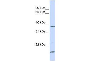 ZDHHC19 antibody used at 1 ug/ml to detect target protein. (ZDHHC19 Antikörper  (N-Term))