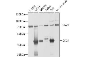 Western blot analysis of extracts of various cell lines, using CD24 antibody (ABIN1512696, ABIN3023213, ABIN3023214 and ABIN6219443) at 1:1000 dilution.