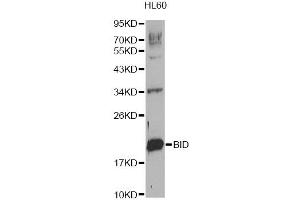 Western blot analysis of extracts of HL-60 cells, using BID Antibody (ABIN1871288). (BID Antikörper)