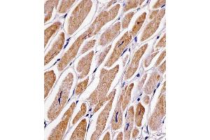 C staining MFN2 in human heart tissue sections by Immunohistochemistry (IHC-P - paraformaldehyde-fixed, paraffin-embedded sections). (MFN2 Antikörper  (AA 447-476))