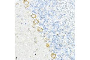 Immunohistochemistry of paraffin-embedded rat cerebellum using RPL10A Rabbit pAb (ABIN6129099, ABIN6147103, ABIN6147104 and ABIN6221624) at dilution of 1:100 (40x lens). (RPL10A Antikörper  (AA 1-110))