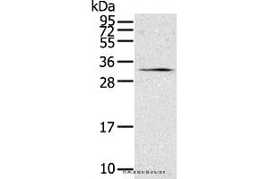 Western blot analysis of 231 cell, using STAR Polyclonal Antibody at dilution of 1:500