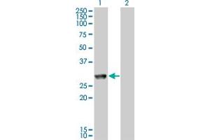 Western Blot analysis of MGC40579 expression in transfected 293T cell line by MGC40579 monoclonal antibody (M11), clone 2C11. (GK5 Antikörper  (AA 1-89))