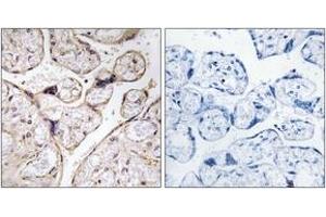 Immunohistochemistry analysis of paraffin-embedded human placenta tissue, using PHCA Antibody. (ACER3 Antikörper  (AA 171-220))