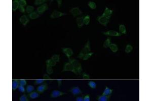 Immunofluorescence analysis of HeLa cells using SS18L1 Polyclonal Antibody at dilution of 1:100. (SS18L1 Antikörper)