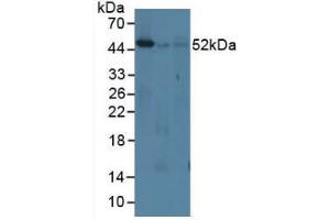 Figure. (IRF8 Antikörper  (AA 1-327))