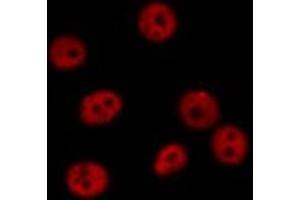 ABIN6269069 staining U-2 OS cells by IF/ICC.