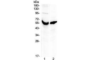 Western blot testing of human 1) placenta and 2) A431 lysate with VDBP antibody at 0. (Vitamin D-Binding Protein Antikörper)