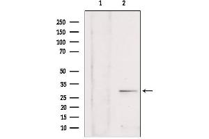 Western blot analysis of extracts from rat brain, using SULT4A1 antibody. (SULT4A1 Antikörper  (C-Term))