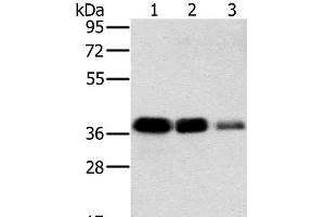 Western Blot analysis of A549, HT-29 and A172 cell using MTFR1 Polyclonal Antibody at dilution of 1:500 (MTFR1 Antikörper)