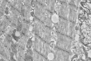 Immunoelectron microscopy analysis of LR white resin-embedded mouse heart using alpha Actinin 2 (ABIN7075510) at dilution of 1: 50. (Sarcomeric alpha Actinin Antikörper)