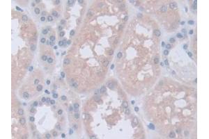 DAB staining on IHC-P; Samples: Human Kidney Tissue (Inversin Antikörper  (AA 1-237))
