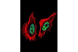 Fluorescent confocal image of Hela cell stained with CTBP1 Antibody . (CTBP1 Antikörper  (C-Term))