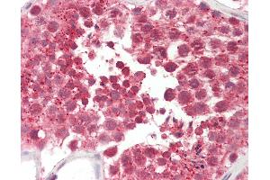 Anti-CILD9 / DNAI2 antibody IHC staining of human testis. (DNAI2 Antikörper  (AA 71-120))