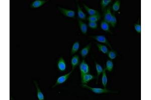 Immunofluorescent analysis of Hela cells using ABIN7151322 at dilution of 1:100 and Alexa Fluor 488-congugated AffiniPure Goat Anti-Rabbit IgG(H+L)