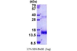 SDS-PAGE (SDS) image for Olfactomedin 1 (OLFM1) (AA 34-135) protein (His tag) (ABIN5777694) (Olfactomedin 1 Protein (OLFM1) (AA 34-135) (His tag))