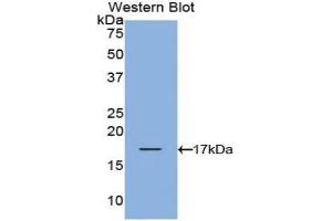 Western blot analysis of the recombinant protein. (TCL1A Antikörper  (AA 1-114))