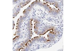 Immunohistochemical staining of human fallopian tube with WDR65 polyclonal antibody ( Cat # PAB27990 ) shows strong membranous positivity in glandular cells at 1:50 - 1:200 dilution. (WDR65 Antikörper)