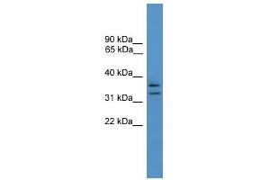 Western Blot showing SCAMP3 antibody used at a concentration of 1-2 ug/ml to detect its target protein. (SCAMP3 Antikörper  (N-Term))