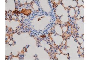 ABIN6267471 at 1/200 staining Mouse lung tissue sections by IHC-P.