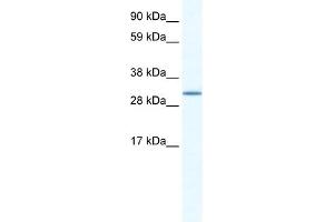 WB Suggested Anti-SPIC Antibody Titration:  1. (SPIC Antikörper  (N-Term))