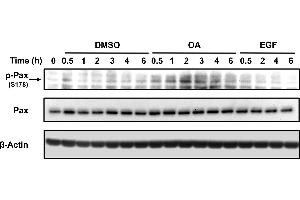 Total protein extracts from serum-starved sub-confluent MDA-MB 231 cells treated with 10 um OA, EGF or DSMO equivalent volume as vehicle control. (Paxillin Antikörper  (pSer178))