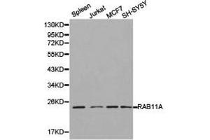 Western Blotting (WB) image for anti-RAB11A, Member RAS Oncogene Family (RAB11A) antibody (ABIN1874497) (RAB11A Antikörper)
